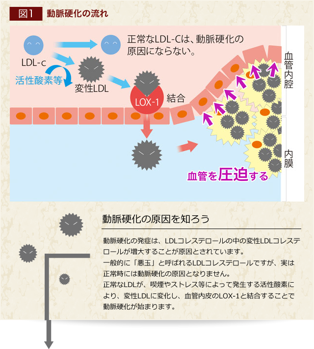 fig01|動脈硬化の流れ